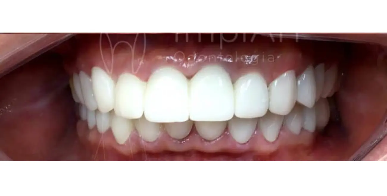 AnyConv.com__dentista